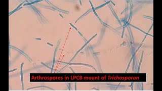 Arthroconidia of Trichosporon inkin Showing Long Cylindrical in Shape [upl. by Mooney]