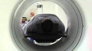 Patient Guide to PETCT [upl. by Imnubulo71]