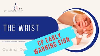 Atypical Development Baby Early Sign of Cerebral Palsy  The Wrists [upl. by Eihpos]