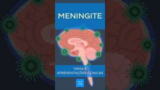 Meningite Tipos e sintomas  Kenhub meningite [upl. by Lura]