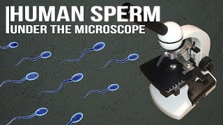 Human Sperm under the microscope [upl. by Julis]