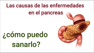 PANCREATITIS CÁLCULOS INSUFICIENCIA PANCREÁTICA DIABETES CÁNCER DE PÁNCREAS FIBROSIS QUÍSTICA [upl. by Araiek]