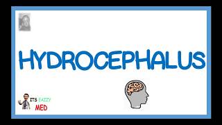 Hydrocephalus Hydrodynamic CSF disorder [upl. by Nivad519]