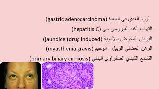 تحليل أضداد الميتوكوندريا في المصل Antimitochondrial Antibodies Test [upl. by Yetac6]