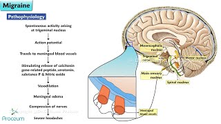 Migraine Medication Animation 🧠 Drug Classes Mechanisms of Action and New Treatments [upl. by Llemej]