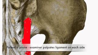 Provocation of Long Dorsal Sacroiliac Ligament Test CR [upl. by Janice995]