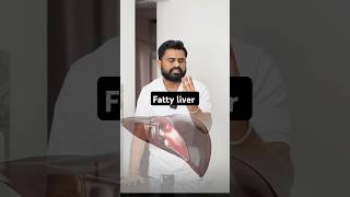 Fatty liver घर के खाने की ताकत को पहचानो drrobin health food ayurved doctor facts remedy [upl. by Ellerad]