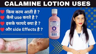 Calamine Lotion Ip Uses in Hindi  Calamine Lotion Uses  Kaise Use Kare  Side Effects  Price [upl. by Ortensia]