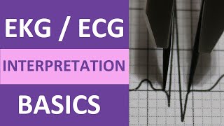 EKGECG Interpretation Basics Nursing NCLEX  QRS Complex P Wave T Wave PR Interval [upl. by Takeo650]