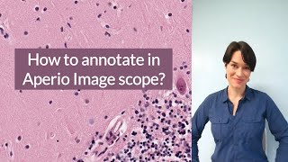 How to annotate in Aperio Image Scope [upl. by Ward470]