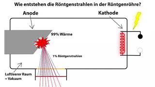 Wie entstehen die Röntgenstrahlen in der Röntgenröhre [upl. by Oliric]