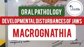 oralpathology  DEVELOPMENTAL DISTURBANCES OF JAWS  MACROGNATHIA Shafers [upl. by Ydnew]