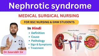 Nephrotic syndrome  medical surgical nursing  For Bsc Nursing and GNM and medical students [upl. by Russom]