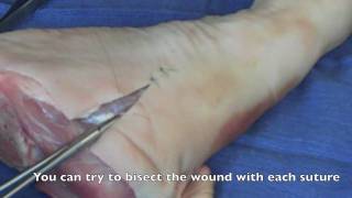 Suture  Basic Technique 2 [upl. by Xanthus]