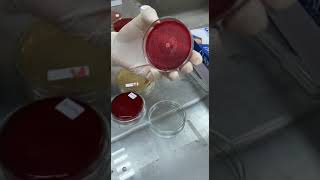 Micrococcus Isolation and Identification [upl. by Nerehs768]