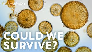 What If All the Microbes Disappeared [upl. by Airdnek]