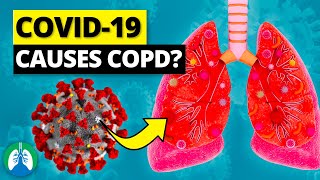 Can COVID19 Cause COPD [upl. by Block]