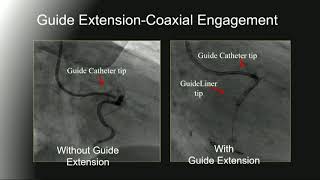 CVI 2019Thursday 718 PCI how to part 1 the basicsCatalin Toma MD [upl. by Naziaf]