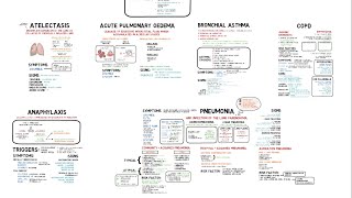 Approach to Dyspnea  Part 1 Sudden amp Rapid Adult Dyspnea [upl. by Ensign]