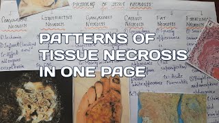 Patterns of tissue necrosisCell injuryGeneral pathology [upl. by Aral124]