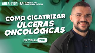 Como CICATRIZAR um ÚLCERA ONCOLOGICA 2x mais rapido  VIDEO AULA 104 [upl. by Assilak]