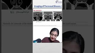 Dr Zainab Vora Explains Imaging of Paranasal Sinuses  Conceptual Radiology [upl. by Nagrom607]