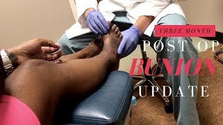 Post Op Bunion Update 2017 [upl. by Nairrod]