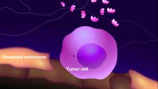 Introduction to Cancer Biology Part 3 Tissue Invasion and Metastasis [upl. by Mccandless85]