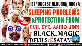 Ruqyah for the Treatment of Incurable Diseases Witchcraft Blackmagic Evil Eye amp Sleeping Problems [upl. by Nnyleimaj]