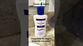 Tratamento de caspa e dermatite seborreica [upl. by Mich270]