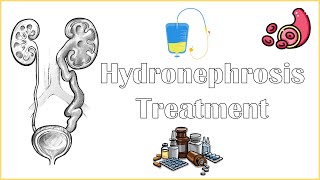 Hydronephrosis Treatment  Medical amp Surgical Management Of Hydronephrosis [upl. by Conney664]