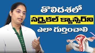 Cervical Cancer Prevention Explained in Telugu I HPV I Dr Anusha [upl. by Asiralc]