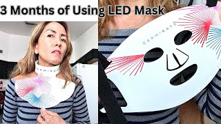 DermRays Light Therapy Mask Review 3 Months Later BIG Results [upl. by Anem]