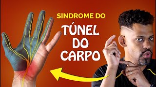 Melhore a SÍNDROME DO TÚNEL DO CARPO com esses exercícios de Mobilidade Neural [upl. by Loesceke26]