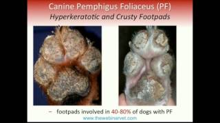 Pemphigus Foliaceus – Recent update on Pathogenesis Diagnostic and Treatment [upl. by Neerahs]