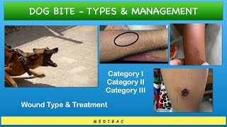 Dog bite  Category 123  Wound types and ManagementTreatment [upl. by Esihcoc]