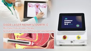 980nm 1470nm Gynecological Laser Vaginal Tightening Machine Triangel TRC [upl. by Evy630]