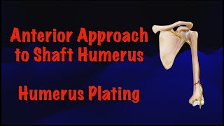 Anterior Approach to Shaft Humerus Humerus Plating Surgical Techniques [upl. by Emmeline650]