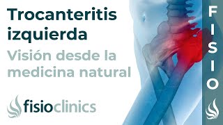 Trocanteritis izquierda Visión desde la fisioterapia y la medicina natural  FisioClinics Palma [upl. by Riplex190]