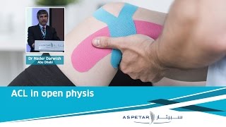 ACL in open physis  Dr Nader Darwish [upl. by Aneerahs]