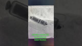 MEDTRONIC MICRA LEADLESS PACEMAKER shorts [upl. by Luamaj27]