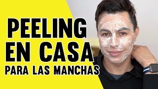 HAZ ESTO UNA VEZ A LA SEMANA PARA QUITAR LAS MANCHAS DE LA CARA Y EL ACNE 2019 [upl. by Chrisy]