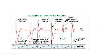 Pacemaker timing cycles and special features  Dr Mohamed Bayoumi [upl. by Yrrehc999]