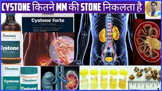 CYSTONE TABLETSYSTONE SYRUP USES AND DOSAGEKIDNEY STONE TREATMENTकिडनी की पथरी का इलाज़ [upl. by Aerahs]