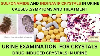 SULFONAMIDE AND INDINAVIR CRYSTALS IN URINECAUSES SYMPTOMS AND TREATMENT OF SULFONAMIDE CRYSTALS [upl. by Nevek676]