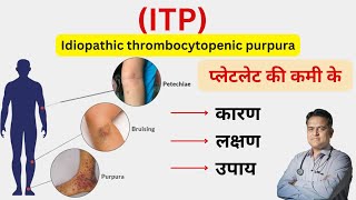 ITP बीमारी क्या है । प्लेटलेट की कम रहने का कारण । Thrombocytopenia symptoms and treatment । [upl. by Khoury935]