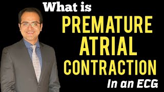 Premature Atrial ContractionComplex PAC ECG Interpretation Atrial Rhythms Treatment USMLE [upl. by Baxy]