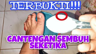 ‍‍‍‍‍🔥Cara Ampuh Mengobati Cantengan Jempol Jari Kaki Dengan Di Rendam Air Garam✅️ [upl. by Anircam585]