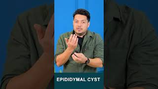 Epididymal Cyst drhealth maleinfertility spermcount himanshudhawan shorts viralshorts [upl. by Doralyn]