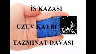 İş Kazası Uzuv Kaybı Tazminat Davası [upl. by Anillek]